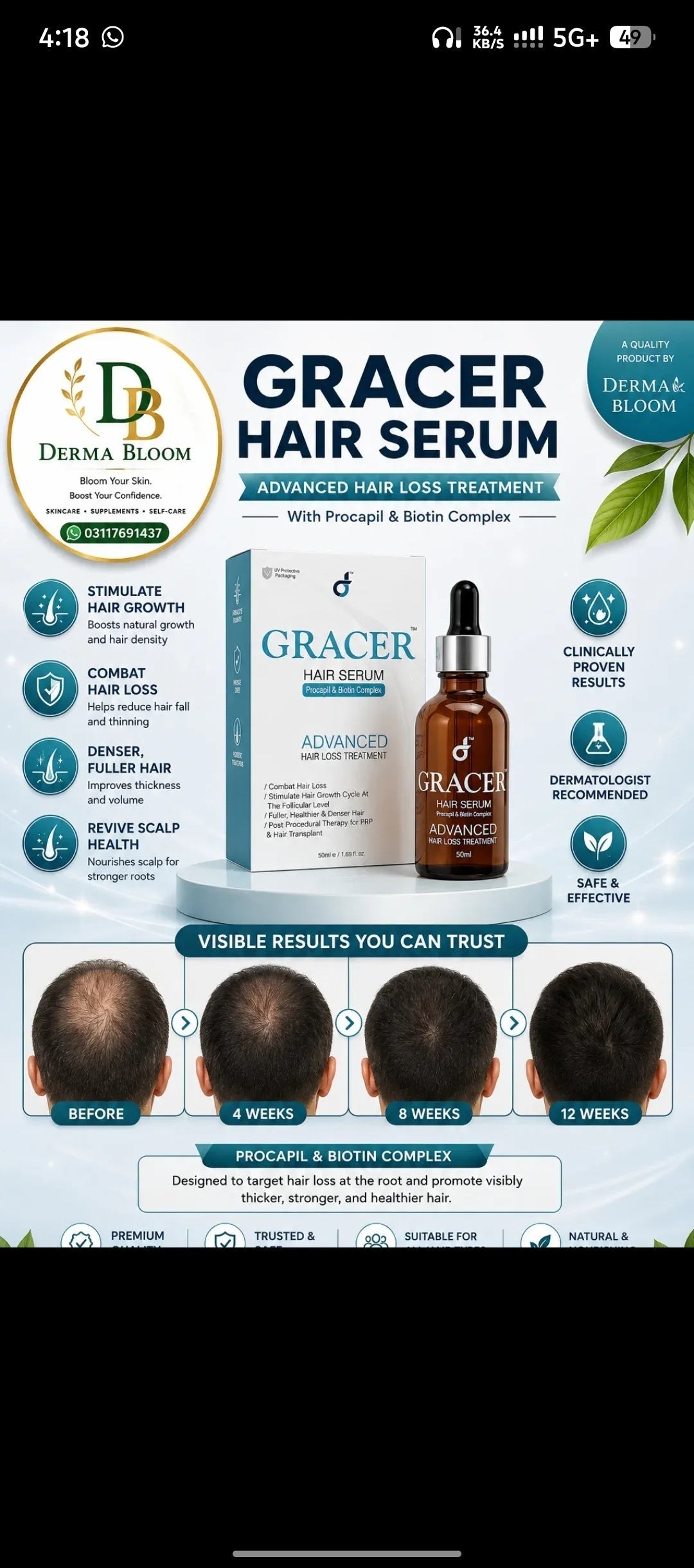 Gracer Hair Serum – Advanced Hair Loss Treatment